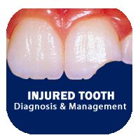 Logo for Injured Tooth