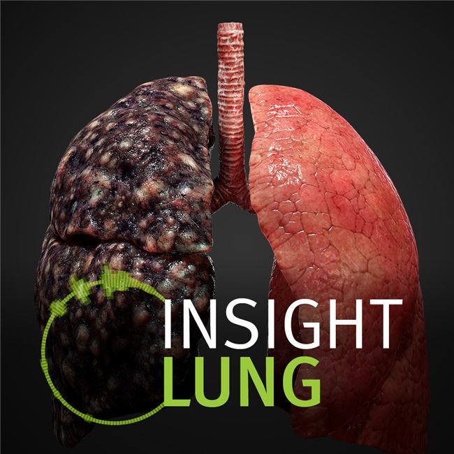 Logo for INSIGHT LUNG